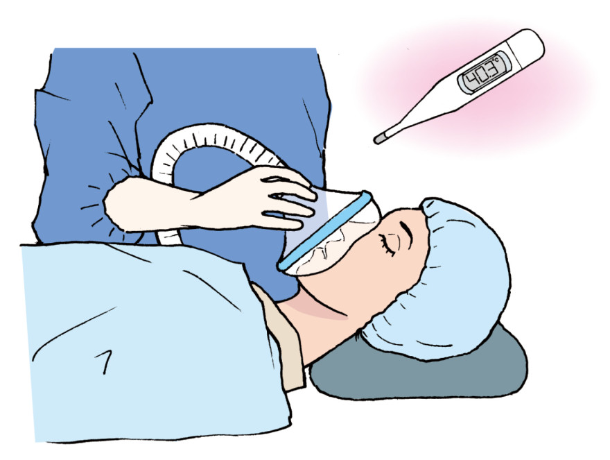 悪性高熱症を引き起こす薬剤の中止