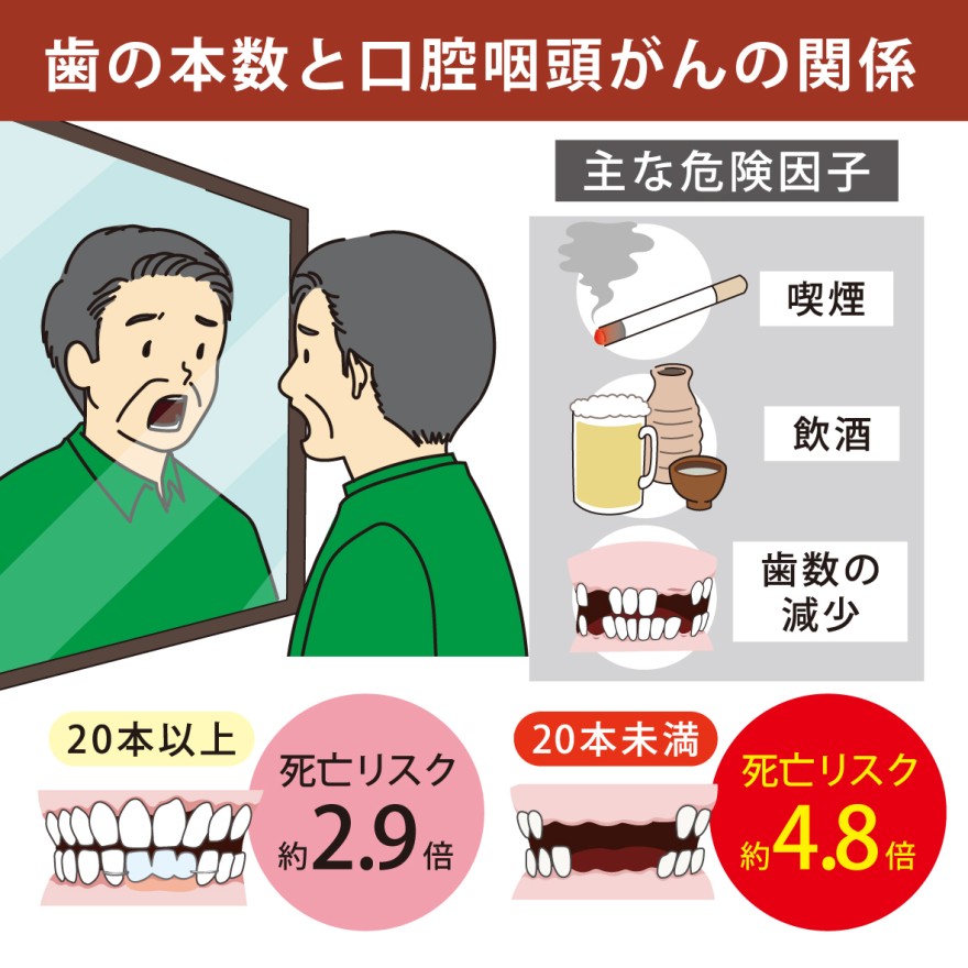 歯数少ない高齢者 口腔咽頭がんリスクに / 函館新聞デジタル